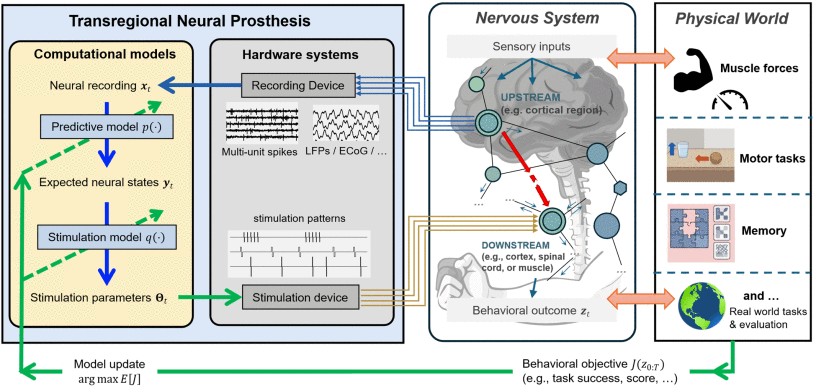 prosthesis